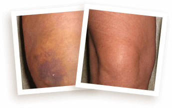 Rodilla 2